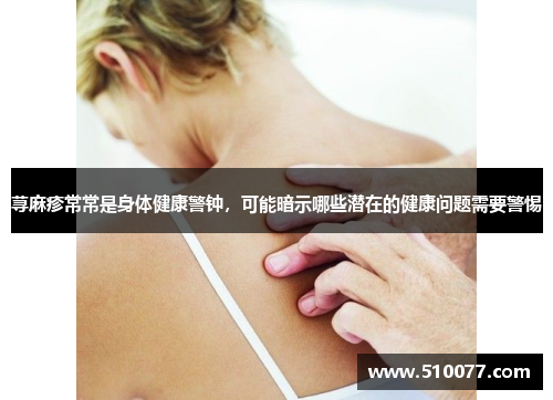 荨麻疹常常是身体健康警钟，可能暗示哪些潜在的健康问题需要警惕